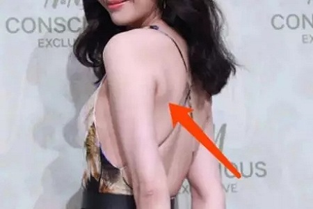 聽(tīng)說(shuō)很多不敢露胳膊的女生,胳膊上都有這個(gè)bug