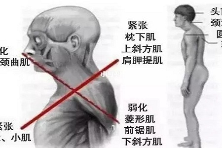 聽(tīng)說(shuō)很多不敢露胳膊的女生,胳膊上都有這個(gè)bug