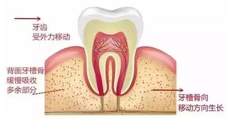 做牙齒矯正 ,真的要趁早!