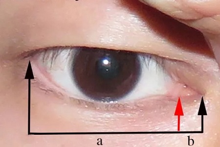 開眼角和不開眼角,差距有多大?