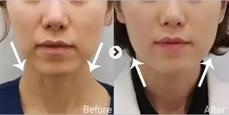 想要衰老來的慢一點(diǎn),你得學(xué)會(huì)保養(yǎng)!