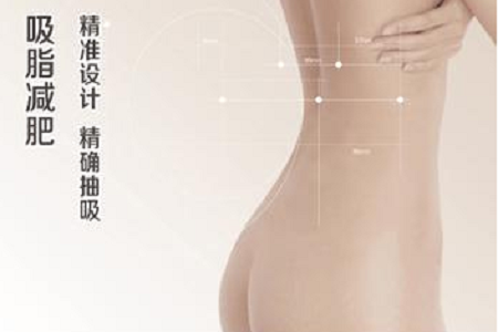 關于吸脂那些不能說的秘密,今天要在這里一次說完!