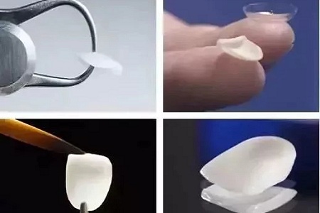 問診室:為什么我的牙卻永遠(yuǎn)也刷不白?