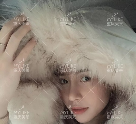 糾結(jié)！鼻頭太圓想塑形是用肋軟骨還是耳軟骨好？