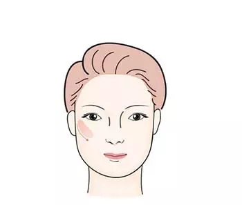 讓明星“一夜回春”的自體脂肪到底適不適合你?