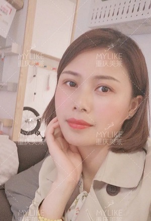 讓明星“一夜回春”的自體脂肪到底適不適合你?