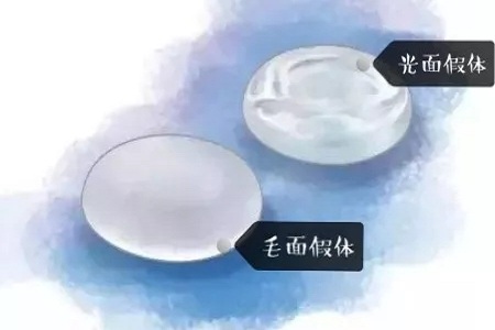 【漲知識】 解讀你較關心的假體隆胸問題!