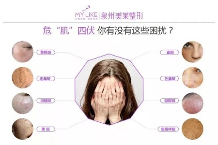 斑，是怎么出現的呢？！