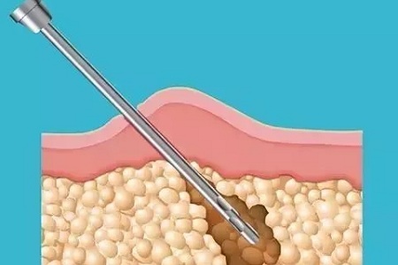 面對減肥這件事,一定要保持頭腦清醒!