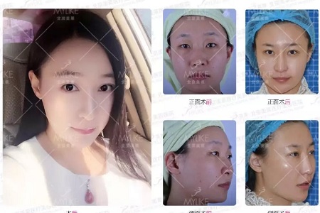 問診室:眼整形犯糊涂的那些事兒