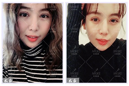 顏值:沒想到姑娘的眼睛竟然修復的這么美