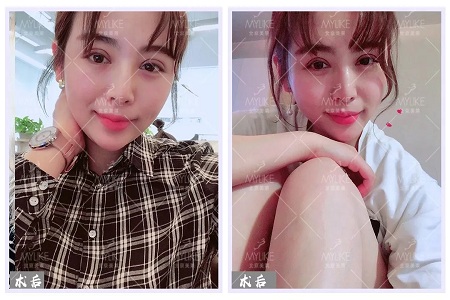 顏值:沒想到姑娘的眼睛竟然修復的這么美