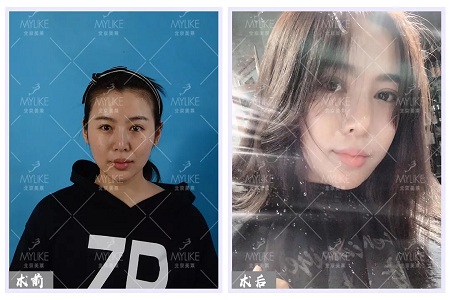 顏值:沒想到姑娘的眼睛竟然修復的這么美