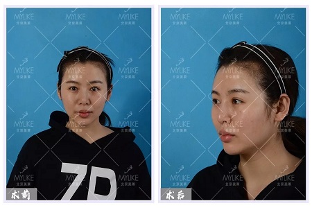 顏值:沒想到姑娘的眼睛竟然修復的這么美