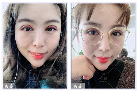 顏值:沒想到姑娘的眼睛竟然修復的這么美