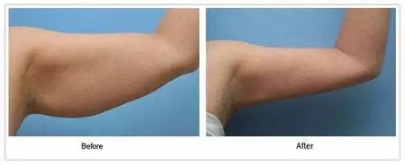 夏天來臨前享“瘦”的正確姿勢,原來是……