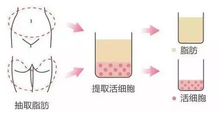 美萊實驗室:當顏值遇上“胸”霸,男人一般都會怎么選?