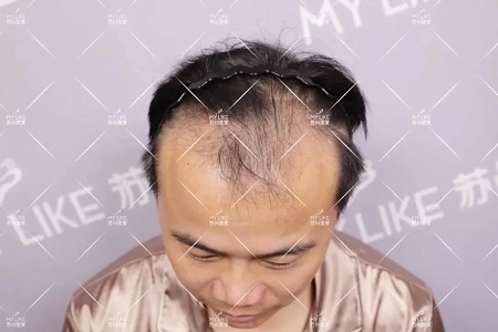 好看的皮囊千千萬,但都有一個共同點-頭發!