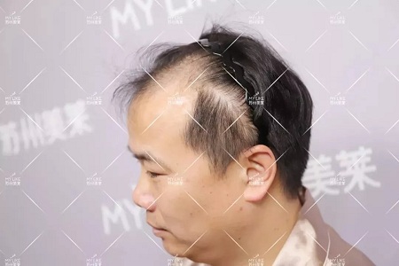 好看的皮囊千千萬,但都有一個共同點-頭發!