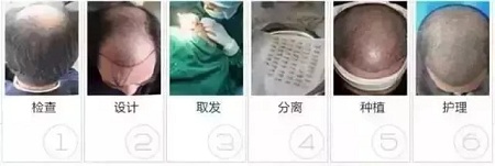 好看的皮囊千千萬,但都有一個共同點-頭發!