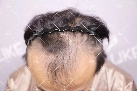 好看的皮囊千千萬,但都有一個共同點-頭發!