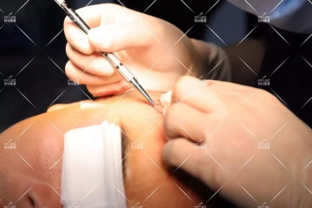 好看的皮囊千千萬,但都有一個共同點-頭發!