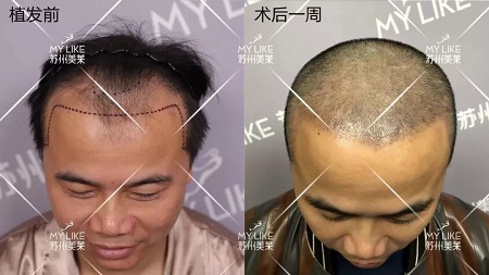 好看的皮囊千千萬,但都有一個共同點-頭發!