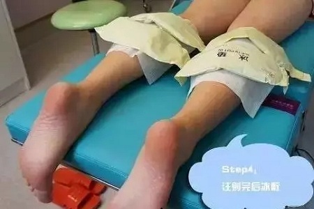 這有一個快速又持久瘦小腿的方法!請注意查收!