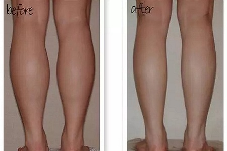 這有一個快速又持久瘦小腿的方法!請注意查收!