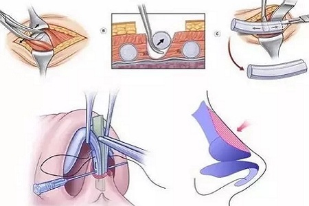 美萊實驗室:漂亮女人果然沒有軟肋