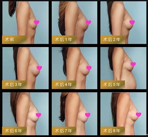 0元豐胸丨12星座維密胸模免費招募火熱進行中!