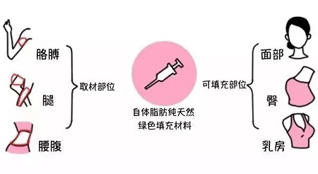 腿再瘦一點(diǎn)?腰再細(xì)一點(diǎn)?胸再大一點(diǎn)?自體脂肪填充,一步到位!