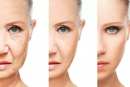 假如年齡可以撒謊,那必然是除皺美容的作用!