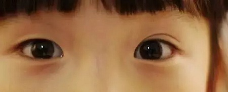 大小眼、不對稱,你是長胖了還是真老了?