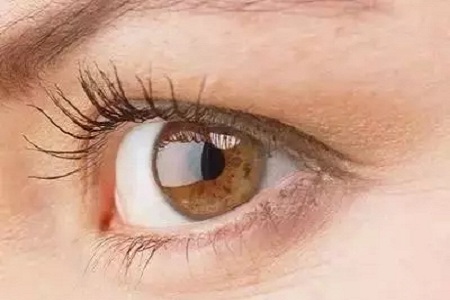 大小眼、不對稱,你是長胖了還是真老了?