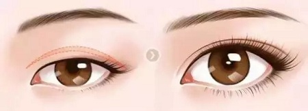 大小眼、不對稱,你是長胖了還是真老了?