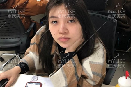 大小眼、不對稱,你是長胖了還是真老了?