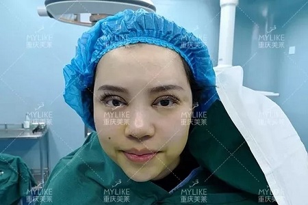 大小眼、不對稱,你是長胖了還是真老了?