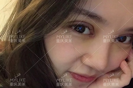 大小眼、不對稱,你是長胖了還是真老了?