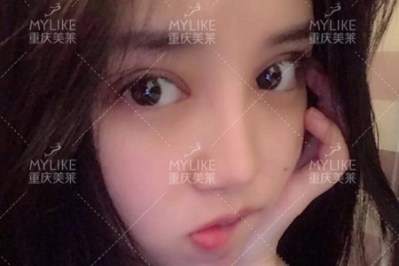 大小眼、不對稱,你是長胖了還是真老了?