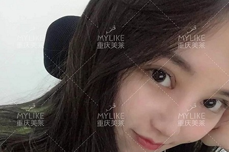 大小眼、不對稱,你是長胖了還是真老了?