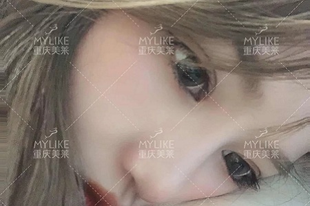 大小眼、不對稱,你是長胖了還是真老了?