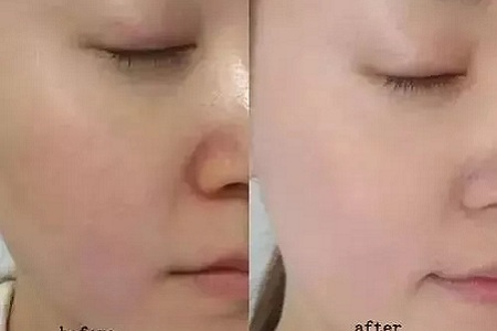 如何在炎熱的夏天,做清爽白凈的小姐姐?