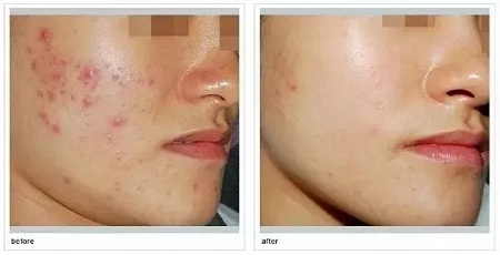 如何在炎熱的夏天,做清爽白凈的小姐姐?