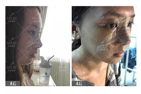 顏值:鼻子一小步,顏值一大步~