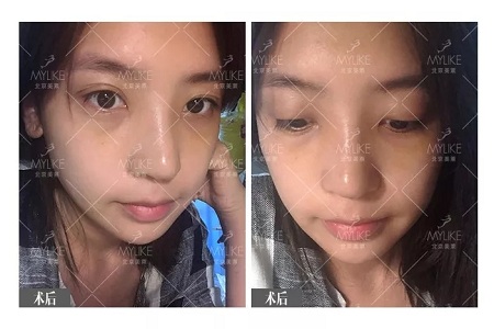 顏值:鼻子一小步,顏值一大步~