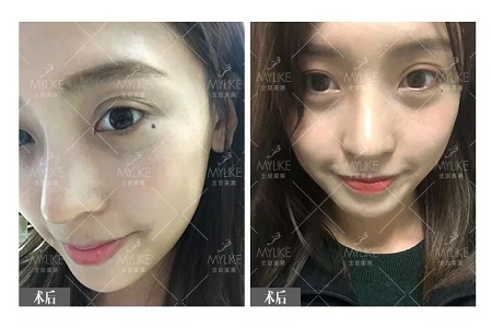 顏值:鼻子一小步,顏值一大步~