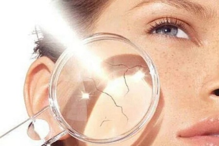 問診室：祛斑不難，找對病因才是重點，祛斑較全面科普看過來