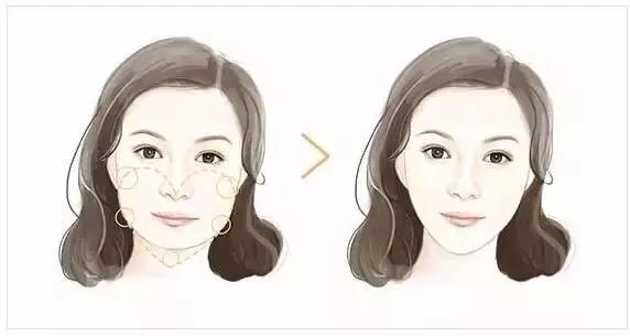 玻尿酸+瘦臉這樣打，方臉、大餅?zāi)樁寄茏冃臉！