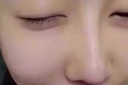 水光,打1次和4次究竟有多大區別?